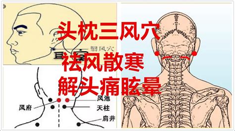 頭風意思|头风 : headache (Chine... : tóu fēng 